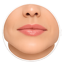Ağız çevresi çizgileri botox bölgesi